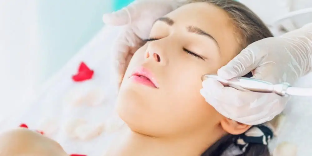 Microdermabrasion