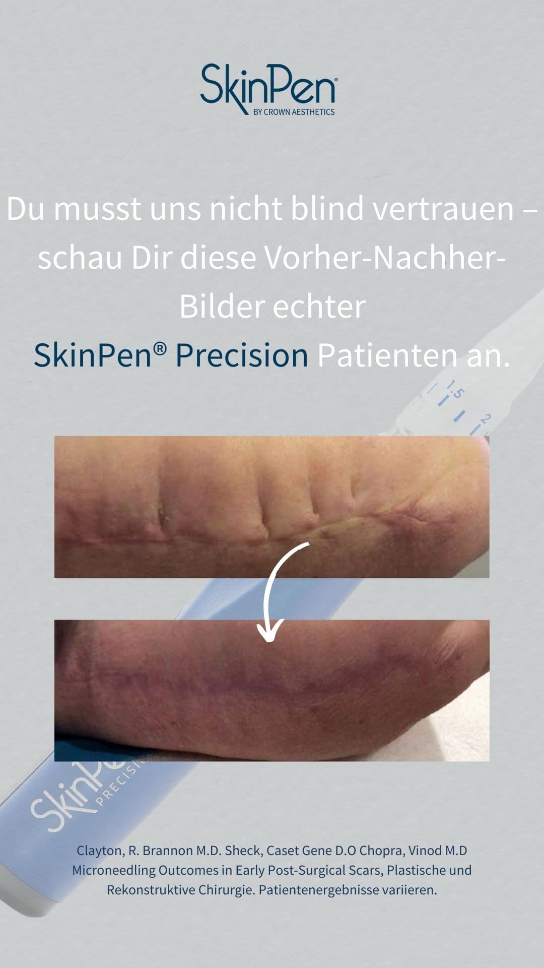 7.4